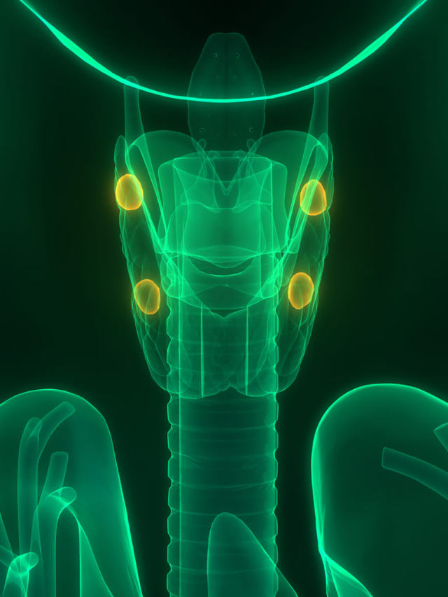 The high vitamin D intake caused hypercalcemia, a buildup of calcium in the body, which contributed to his death.
