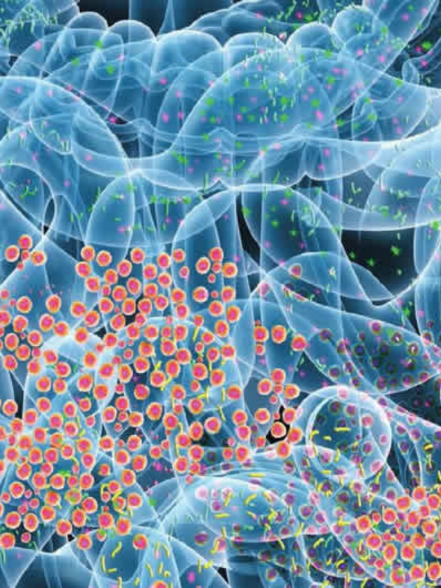 Gut Bacteria and Alzheimer’s
