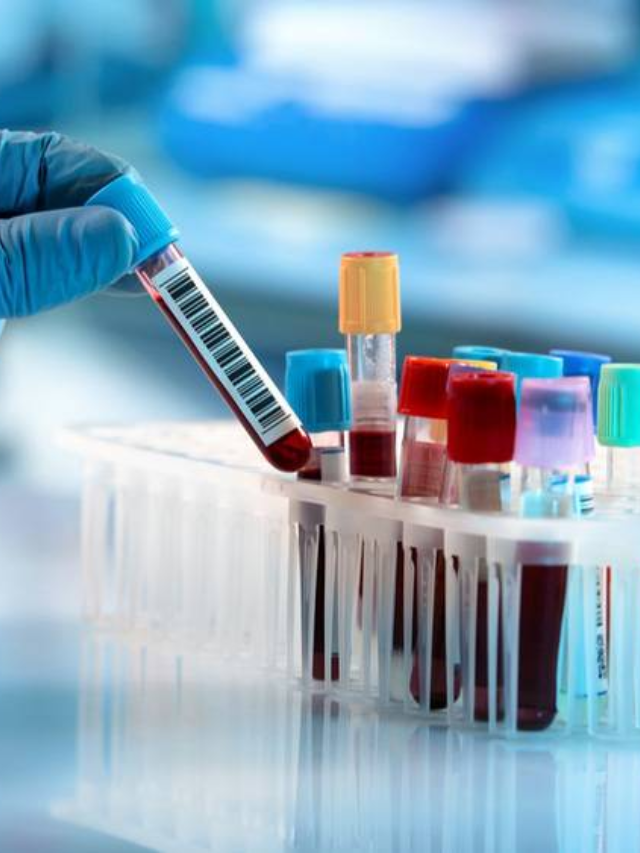  Lab Findings Support Concerns
