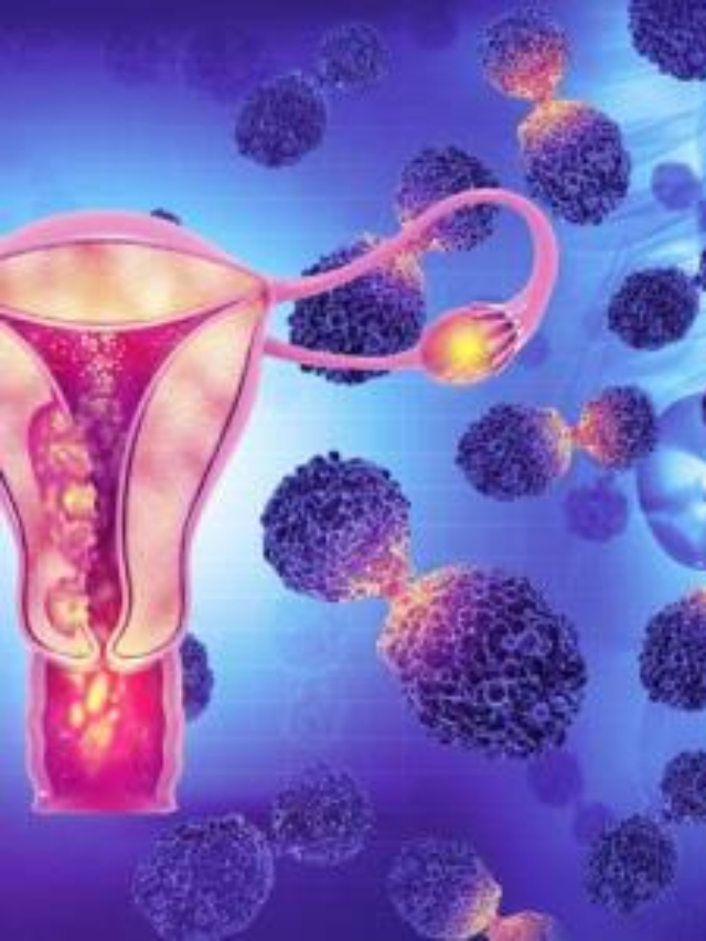 Endometrial Cancer Signals Ignored