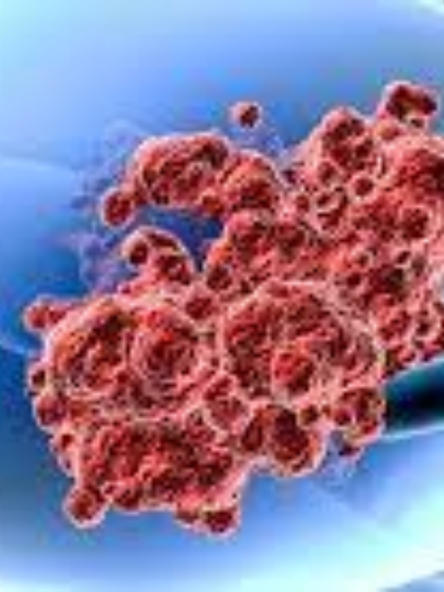 Endometrial Cancer Signals Ignored