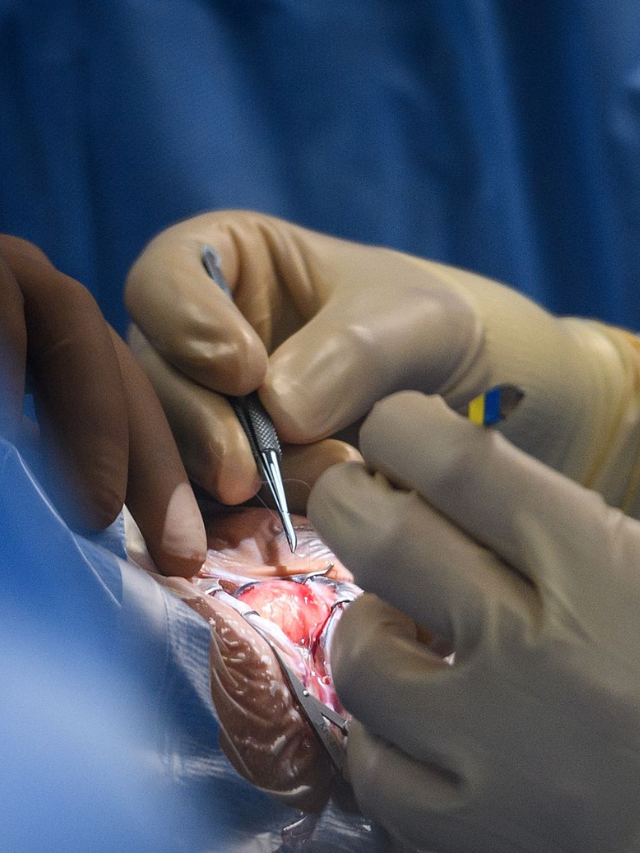 US Man Dies After Wrong Organ Removed in Surgery